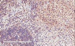 Integrin alpha L/CD11a Antibody, Novus Biologicals 0.1mg; Unlabeled:Antibodies,